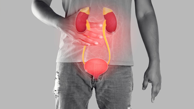 Infeksi Saluran Kemih: Cara Menjaga Kebersihan Organ Intim – PAFI Selat Panjang